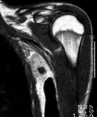 MRI CE-T1WIf