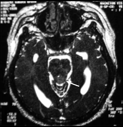 MRI@CISS Images