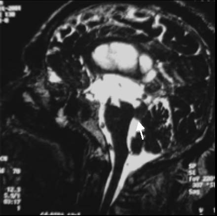 MRI@CISS Images
